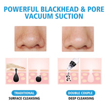 Load image into Gallery viewer, Blackhead Vacuum with Infrared Therapy